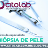 Núcleo de Dermatopatologia 