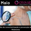 MELANOMA - Foco no diagnóstico